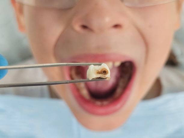 Best Weekend Emergency Dentist in Lynwood, IL